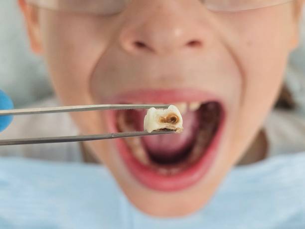 Best Emergency Pediatric Dental Care in West Kennebunk, ME